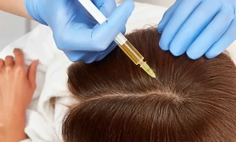 hair-mesotherapy3-780x470